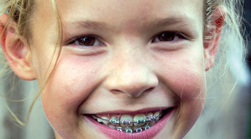 djevojcica sa protezom