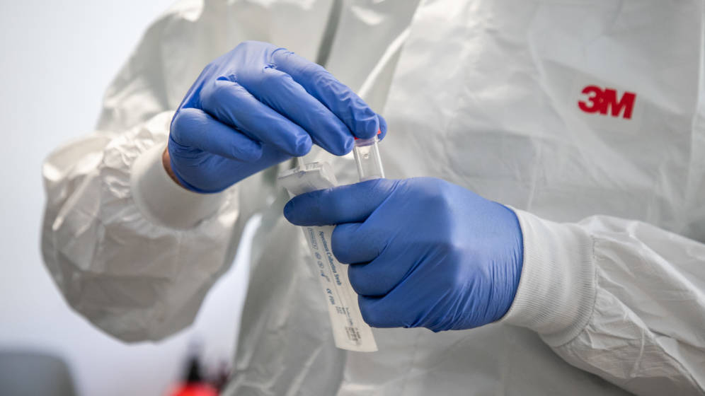 Registrovano 289 novopozitivnih slučajeva infekcije, u Beranama 18