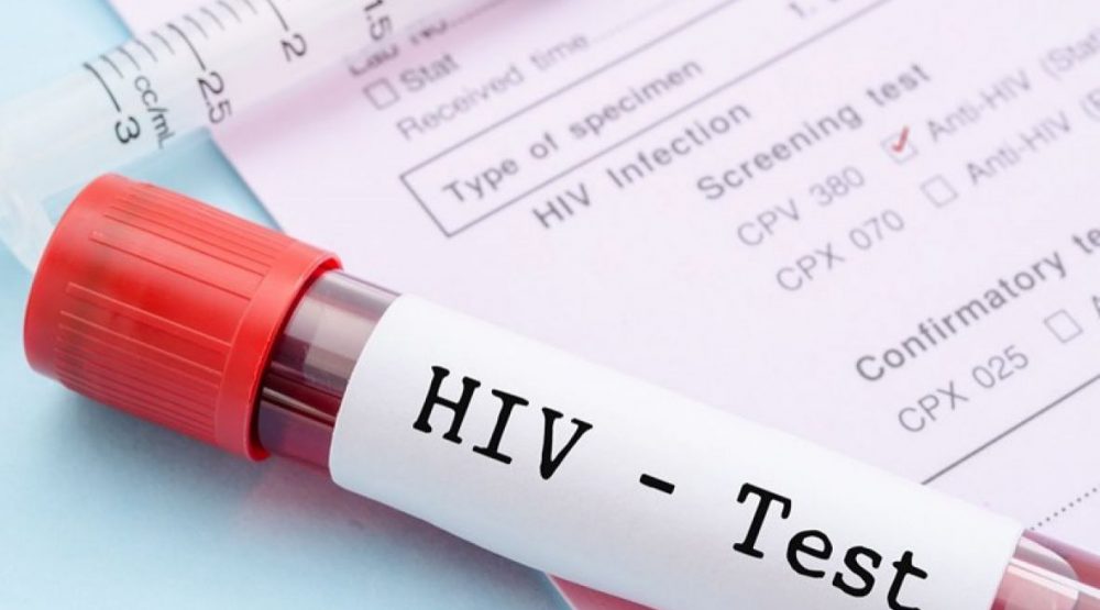 Održano testiranje na HIV i Hepatitis