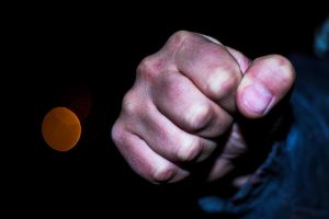 Berancu krivična prijava zbog teške tjelesne povrede